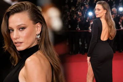 Serenay Sarıkaya hakkında estetik iddiası yeniden gündem oldu